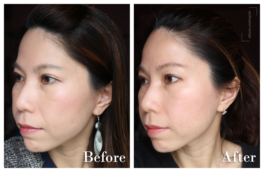 Astute Medical Centre Facial Harmony Program