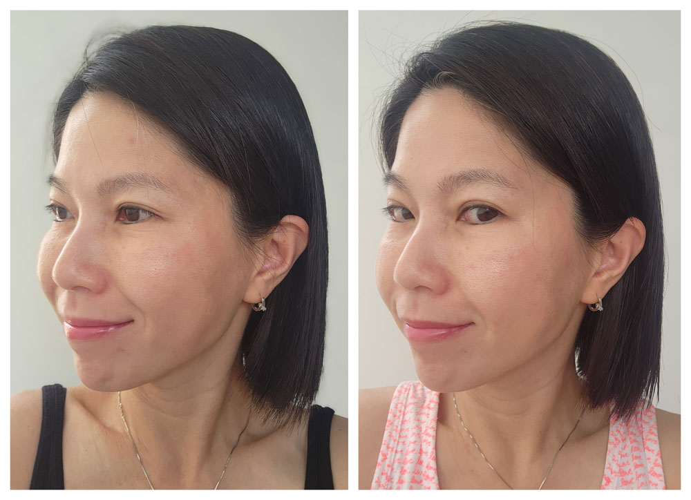 Secret Duo Before After - Left Side View (Smile)