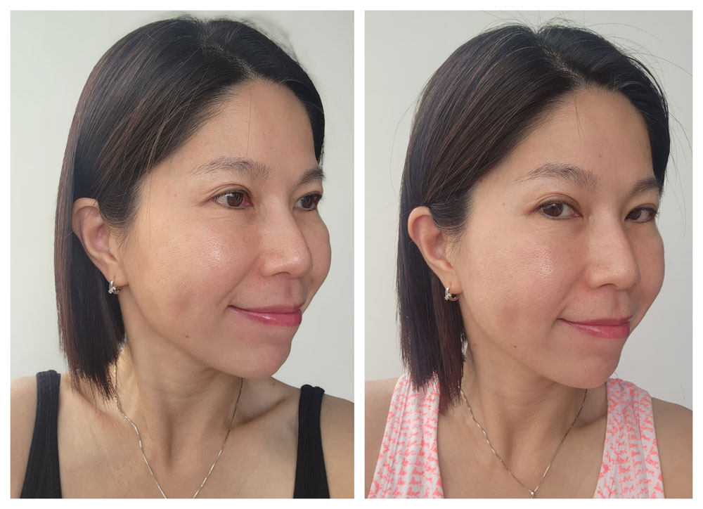 Secret Duo Before After - Right Side View (Smile)