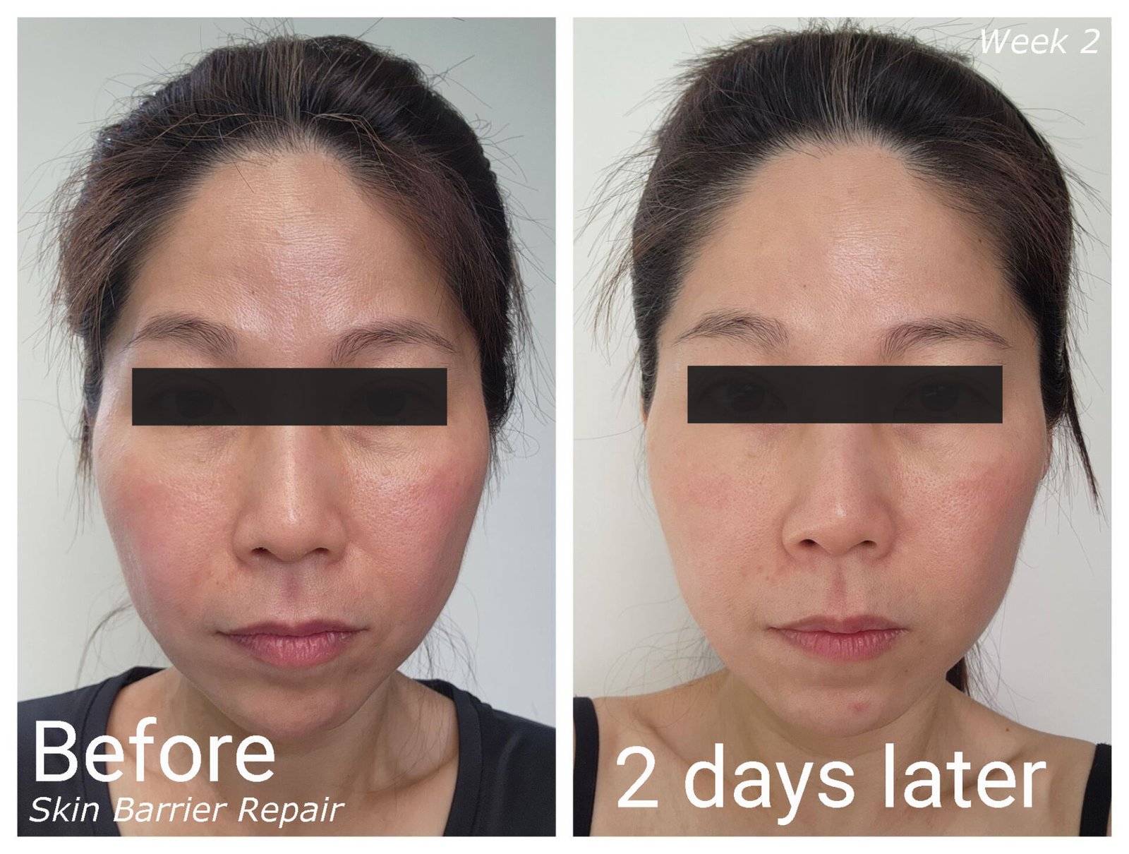ZIIP HALO Before-After Skin Barrier Repair