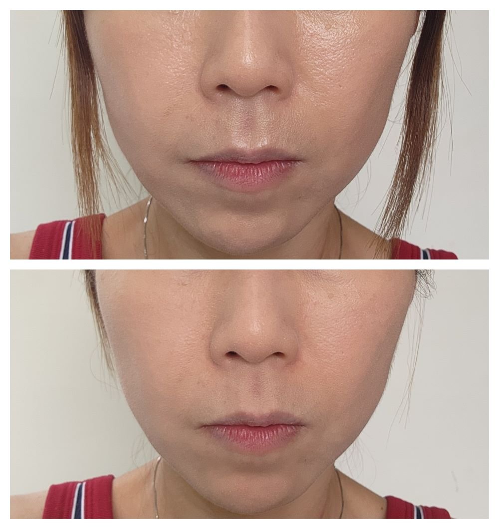 Decorte Loose Powder before-after
