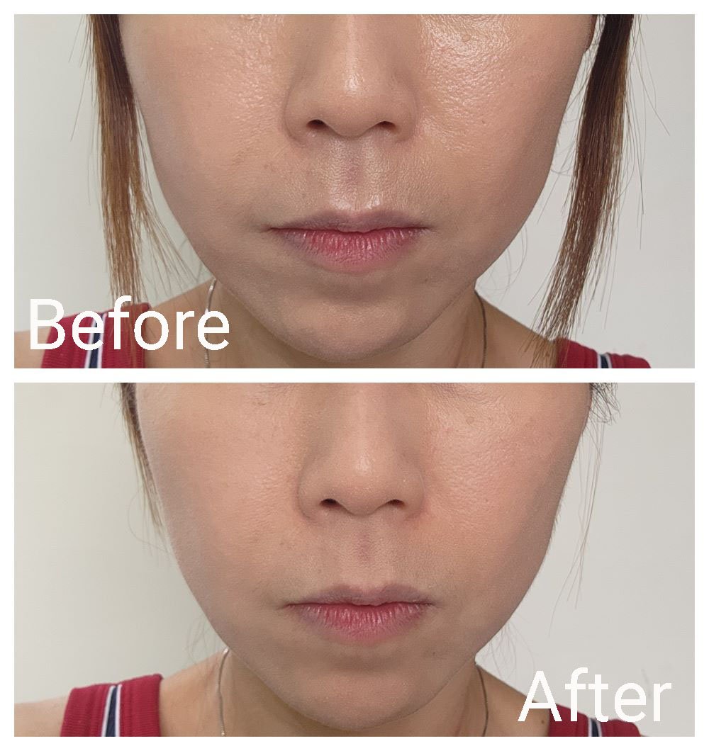 Decorte Loose Powder before-after